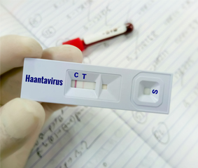 Χανταϊός: Ένα σοβαρό ζήτημα δημόσιας υγείας