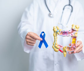 Καρκίνος παχέος εντέρου: Γιατί αυξάνεται στα άτομα κάτω των 50 και πώς προλαμβάνεται