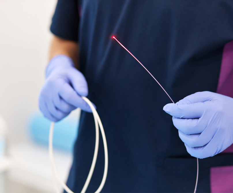 Ενδοαυλική θεραπεία με laser: η σύγχρονη λύση στο πρόβλημα των κιρσών και της φλεβικής ανεπάρκειας
