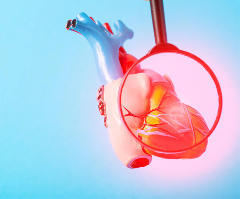 Stress Perfusion MRI:  Η εξέταση που ανιχνεύει με ακρίβεια καρδιακές παθήσεις