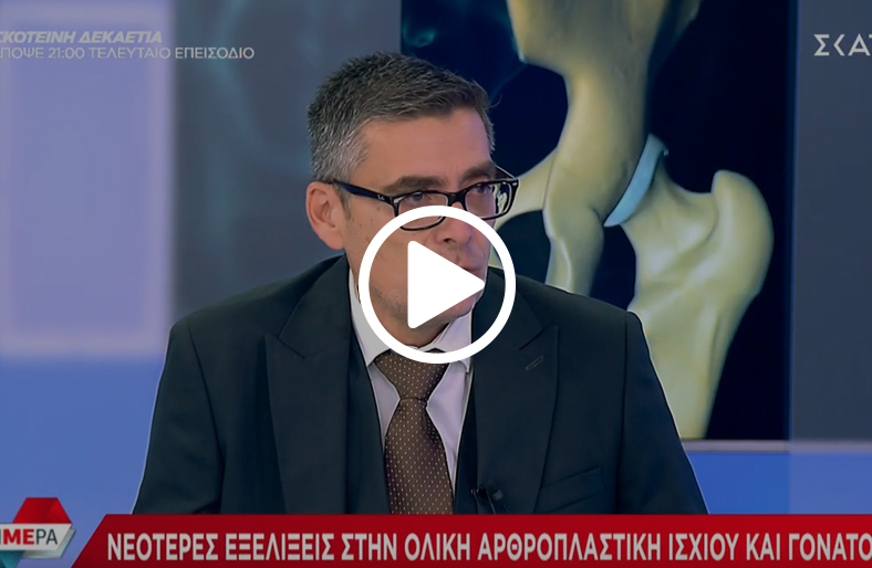  Ολική αρθροπλαστική: νεότερες τεχνικές | Νικόλαος Μπαξεβάνος 